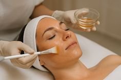 Peeling avanzado